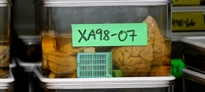 alzheimer708.jpg