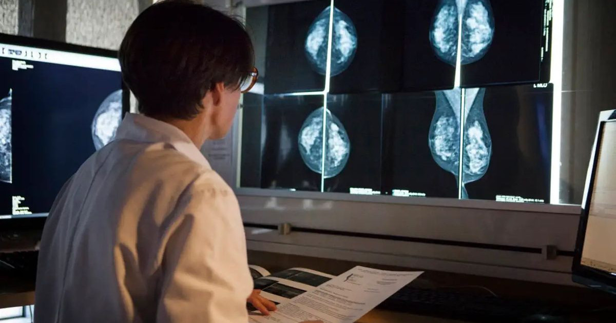 ai-breast-cancer-detection.jpg