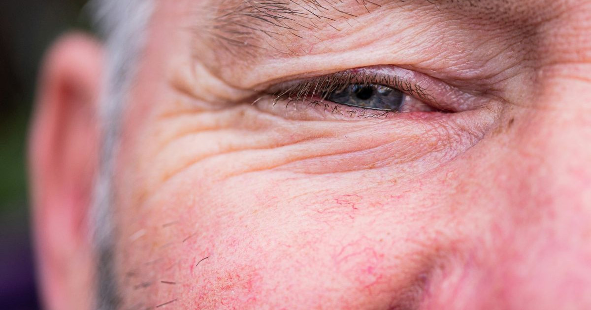 glaucoma-hdl.jpg