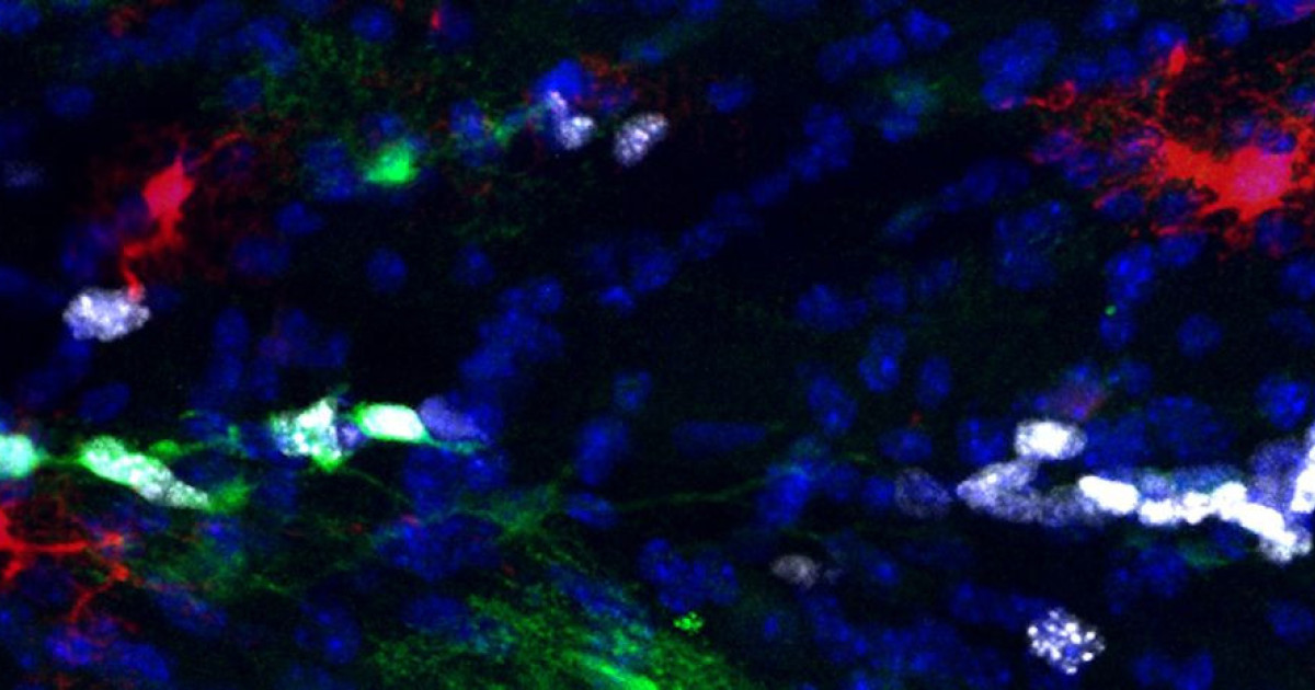 astrocytes.jpg