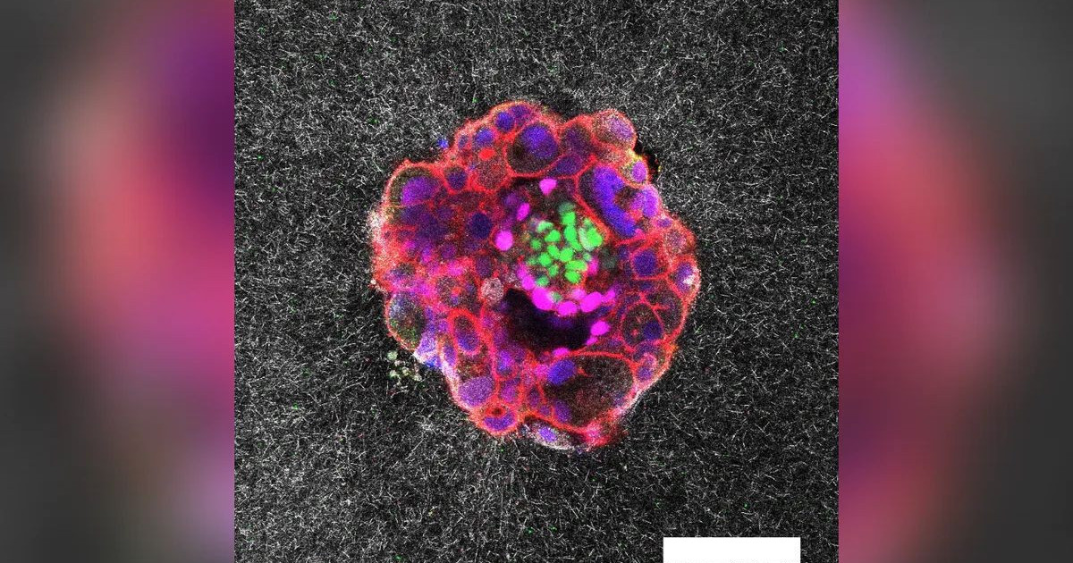 human-embryo-real-time.jpg