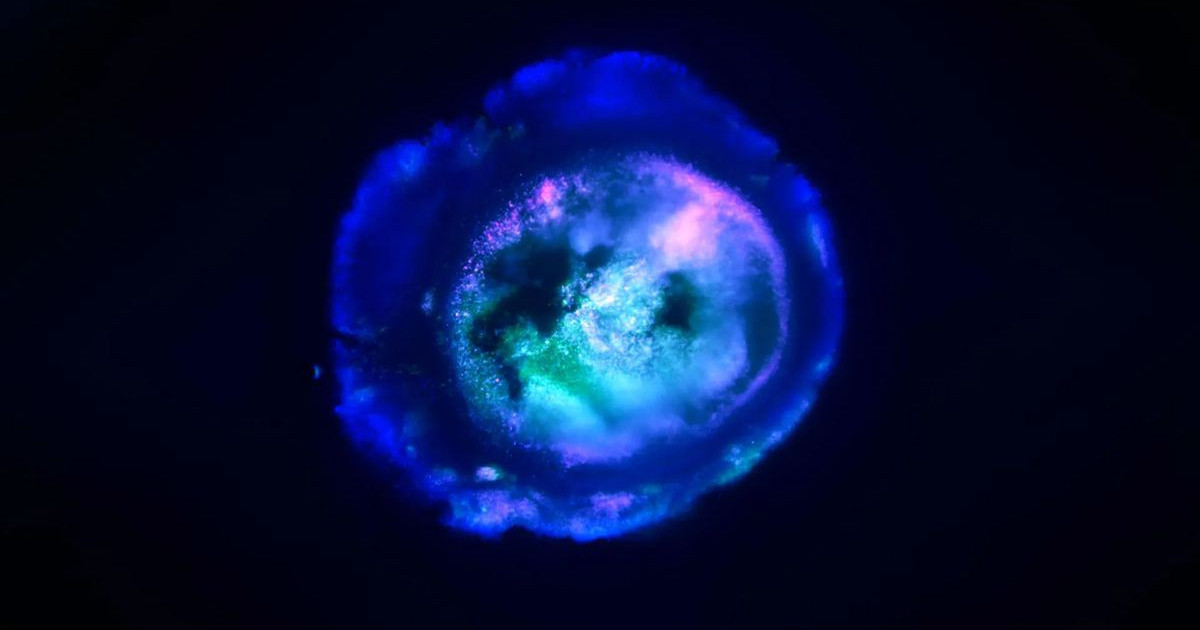 mini-brain-johns-hopkins.jpg