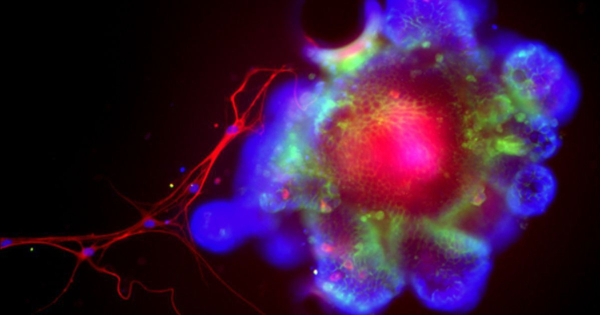 alcohol-bacteria-liver.jpg
