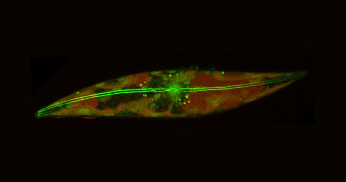 stanford-diatoms.jpg