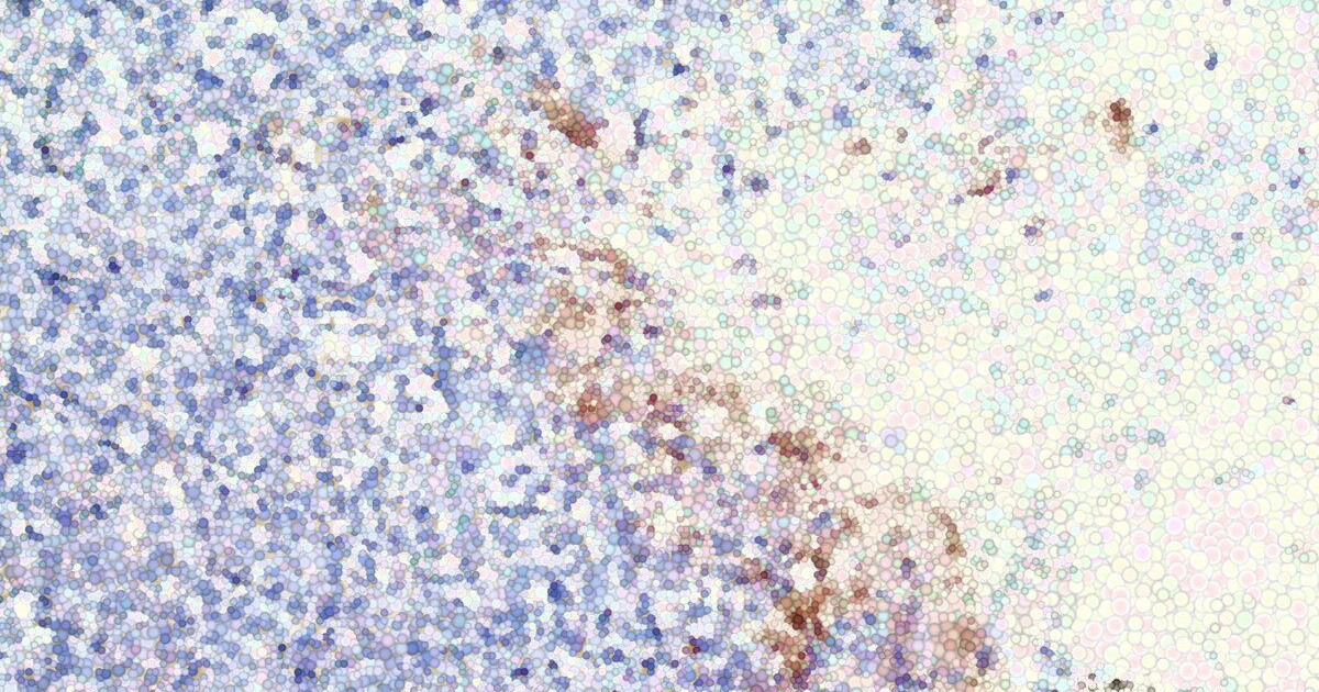 crispr-cancer-lung.jpg