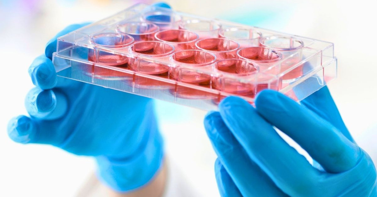stem-cell.jpg