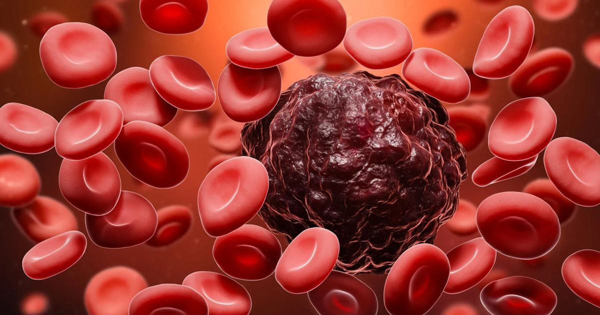 forskolin-leukemia.jpg