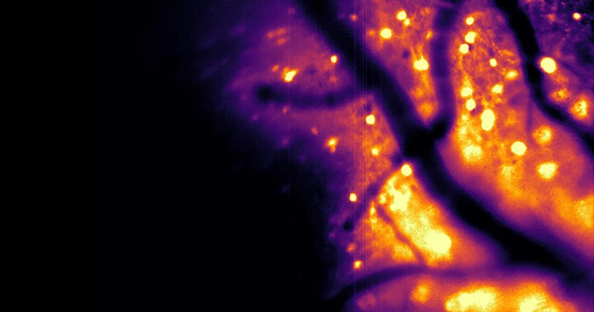 cortical-neurons.jpg