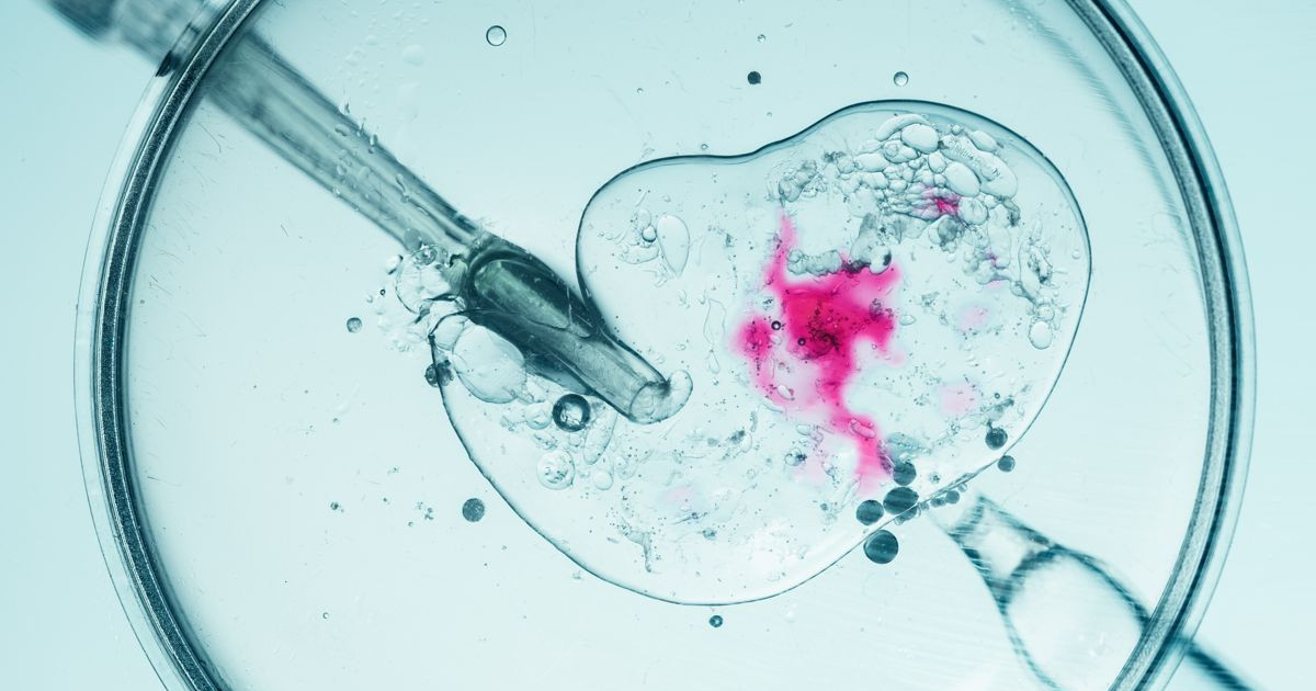 ivf.jpg