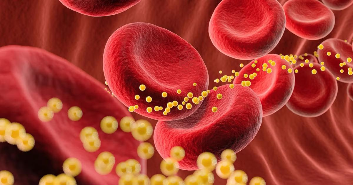 enzyme-obesity.jpg