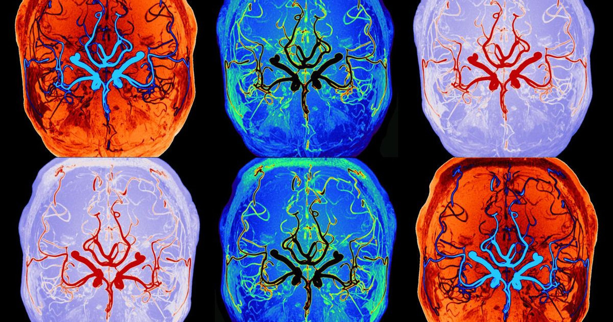 brain-cleaning-real-time.jpg