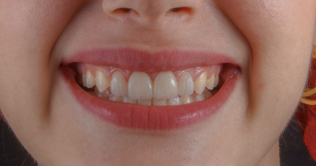 healthy-teeth.jpg
