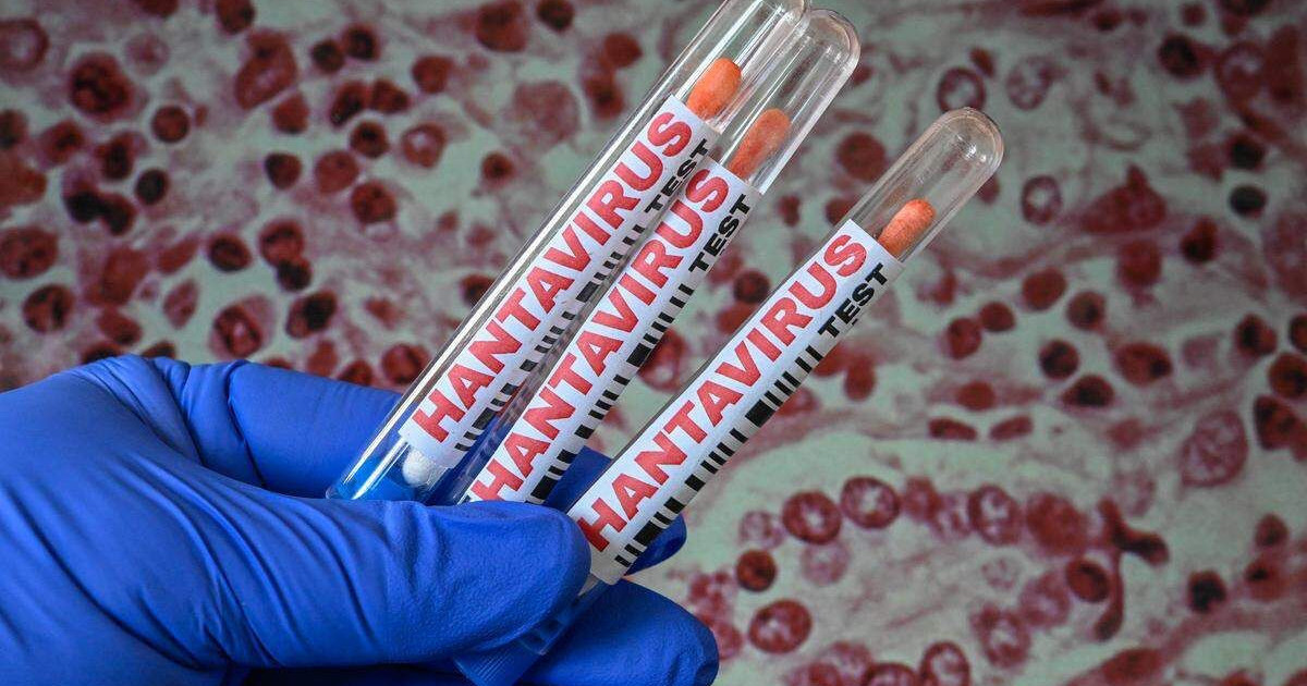 hantavirus-test.jpg