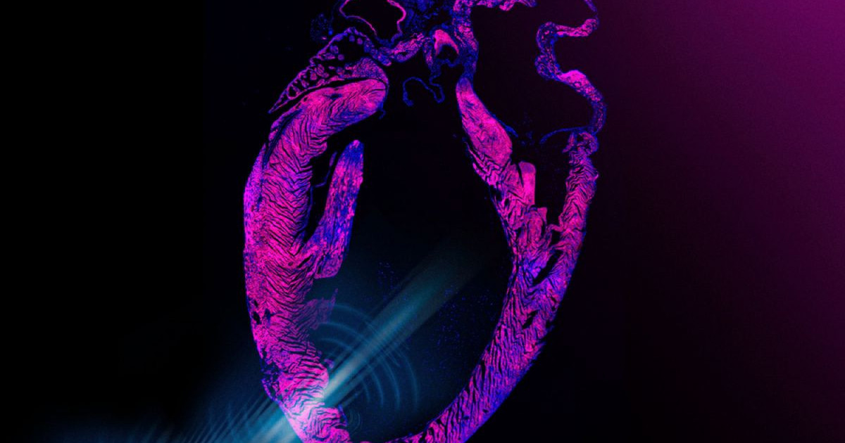 mit-ultrasound-pacemaker.jpg