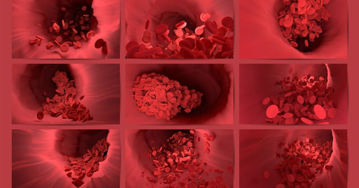 3d-printed-artery-on-chip.jpg