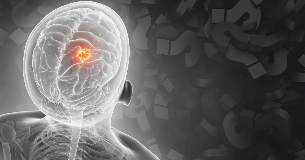 ai-cancer-therapy.jpg