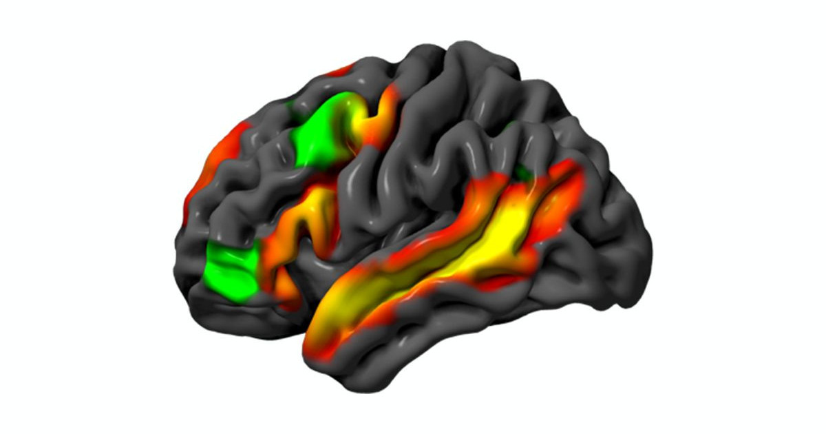 mit-brain.jpg