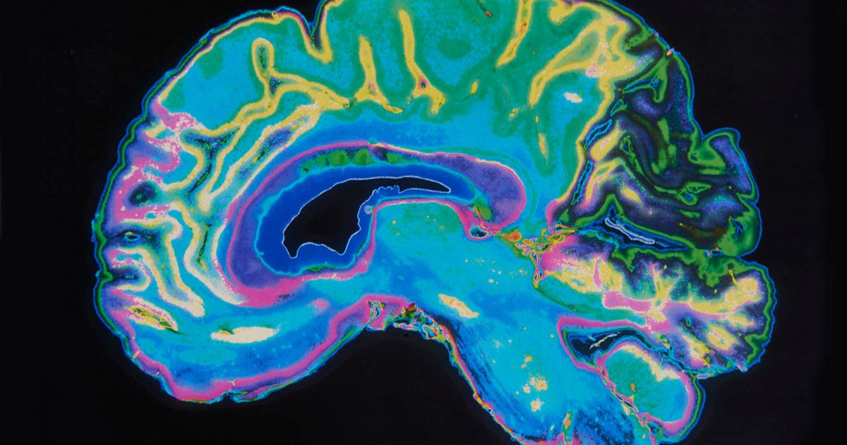 brain-two-organs.jpg