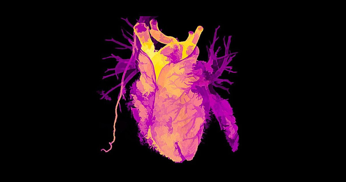 transplant-heart.jpg